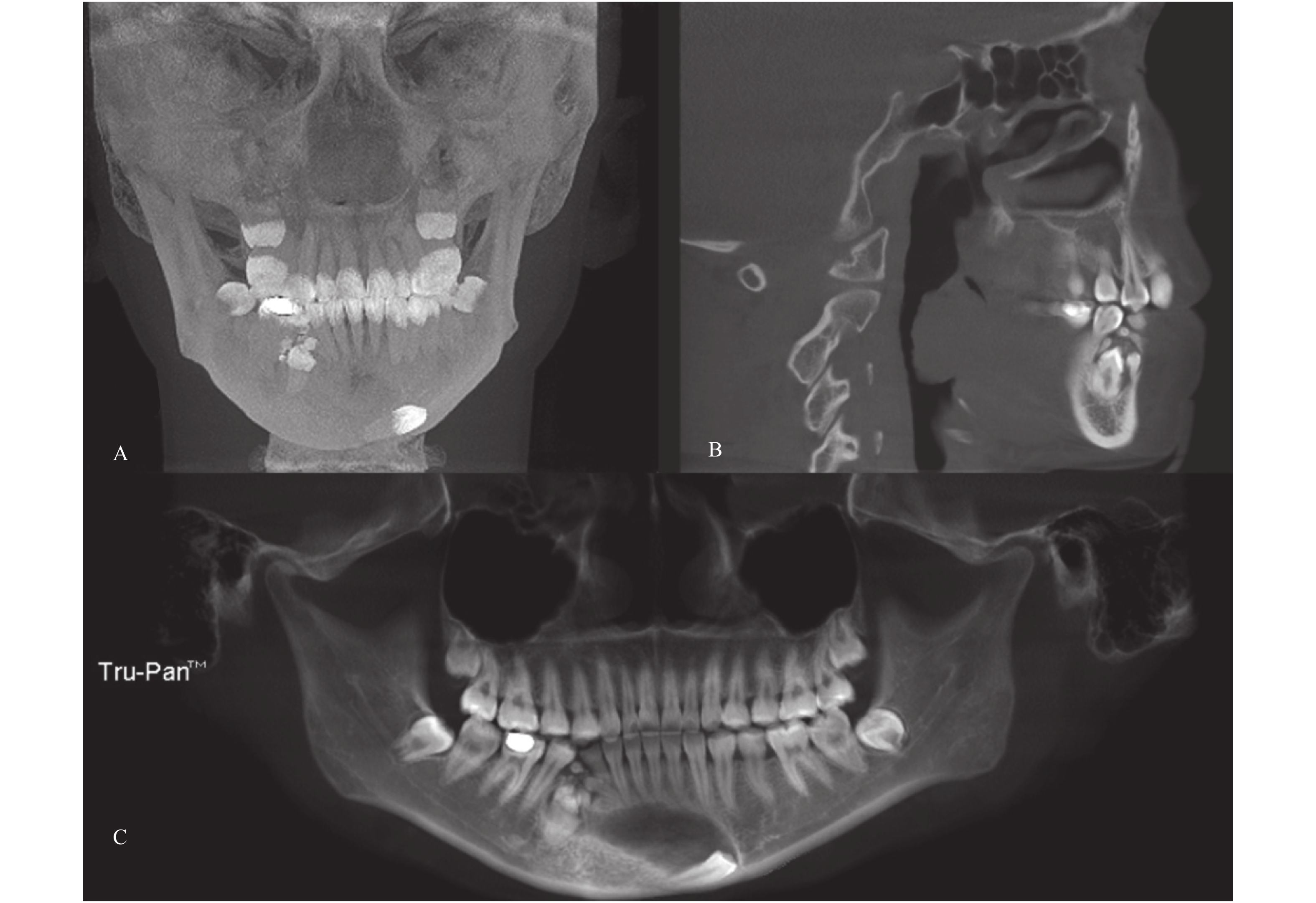 你知道为什么看牙需要拍口腔CT片吗？ - 知乎